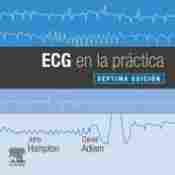ECG EN LA PRÁCTICA
