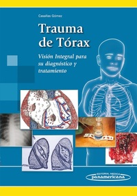 TRAUMA DE TÓRAX VISIÓN INTEGRAL PARA SU DIAGNÓSTICO Y TRATAMIENTO
